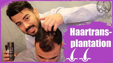 See full list on hairforlife.info Transformation - volle Haare ohne Haartransplantation ...