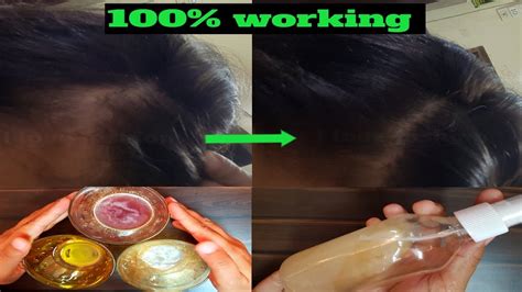 This won't make your hair grow and is only recommended for people who want to dye while they're growing it out and don't want to damage it with commercial dyes. How to grow thick hair naturally - YouTube