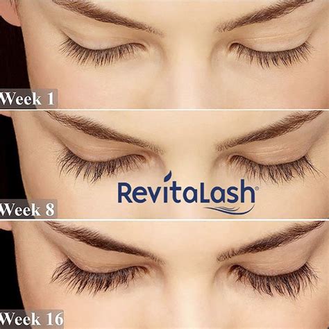 Depending on results ( and sides ? REVITALASH 💙 -#1 selling , award-winning formula. Enhances ...