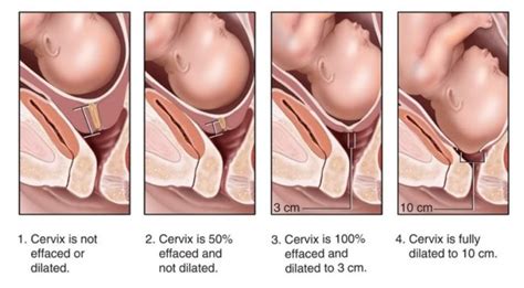 It is now referred to as nt command line. Milenium Home Tips: What Does Thinning Of The Cervix Mean