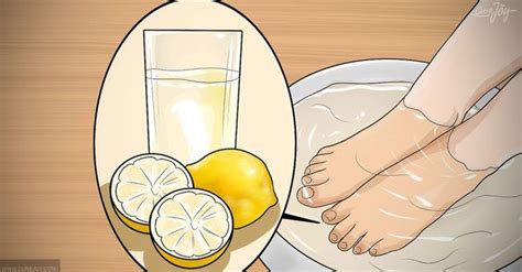 Maybe you would like to learn more about one of these? Natural Remedies To Get Rid Of Yellow Toenails | Remedies ...