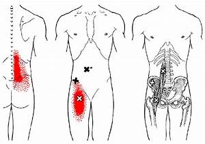 Hüftmuskel The Trigger Point Referred Guide