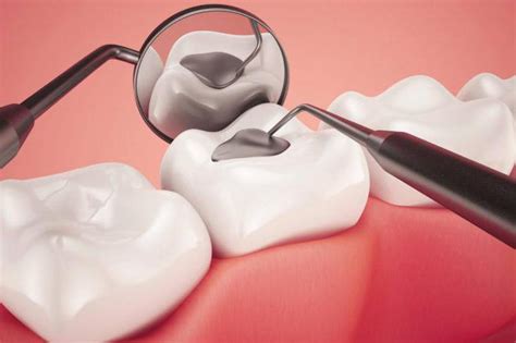 Zub koji je traumatiziran i pomičan fiksira se tzv. Kak Narisovat Zub - Kak Narisovat Zub - Uroki Risovaniya ...