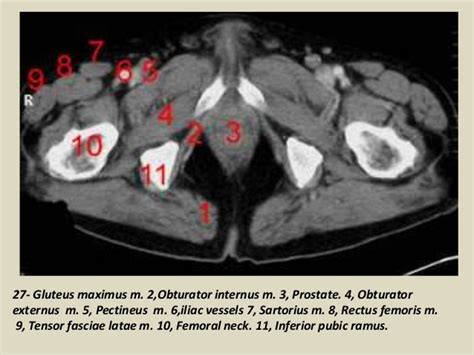 To maintain the continence of urine and faeces. Presentation1.pptx, ct normal anatomy of the abdomen and ...