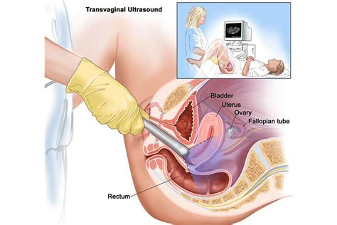 There are some adverse effects of hot tubs during pregnancy. Is It Safe To Have A Transvaginal Scan During Pregnancy?