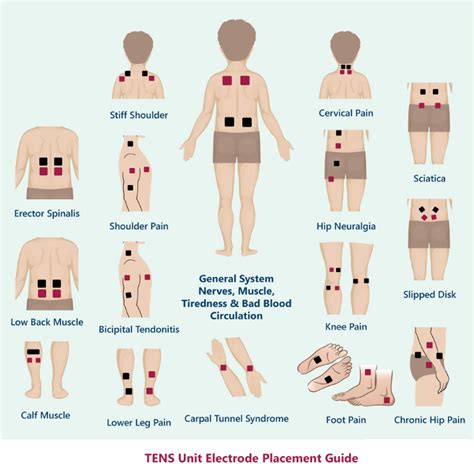 Decide which size of electrode is best for your condition by following the tens pad placement suggestions as outlined in the electrode pad placement guides pictures below. Pin on Health and Healing