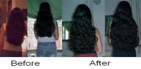 Biotin is in every hair growth pill. Biotin Hair Growth: Biotin Hair Growth Before And After ...