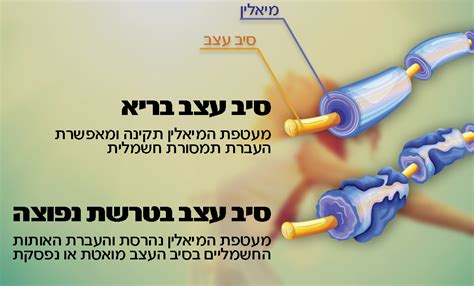 However, the exact cause is not known. התרופה החדשה שנותנת תקווה לחולי טרשת נפוצה