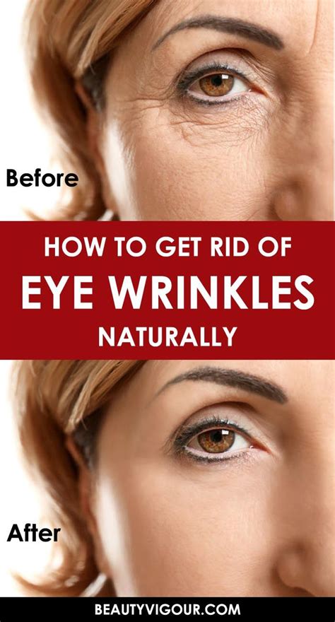 Wearing goggles will prevent dust from getting in your eyes. How To Get Rid Of Eye Wrinkles Naturally - BeautyVigour ...