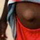 Maybe you would like to learn more about one of these? Hernia Symptoms, Signs, Types, Treatment, Surgery & Pictures