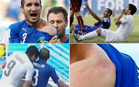 In the group d game between italy and costa rica, costa rican forward joel campbell was kicked by italian defender giorgio chiellini in the penalty area while looking for a goal, but chilean referee enrique osses failed to award a penalty, enraging costa rica's coach jorge luis pinto. Suarez e Chiellini arriva la verità "Chiedo scusa, era un ...