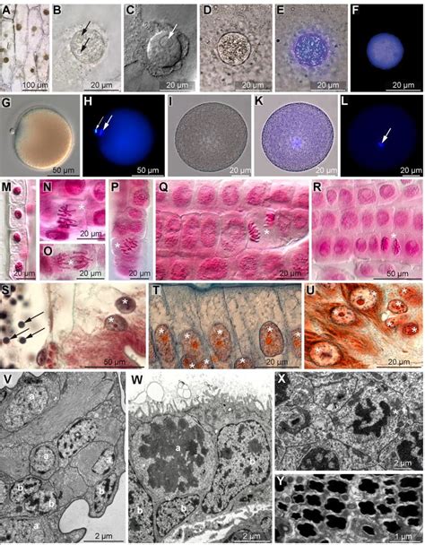 Check spelling or type a new query. A-F. Allium cepa (Amaryllidacea, Magnoliopsida), nucleus ...