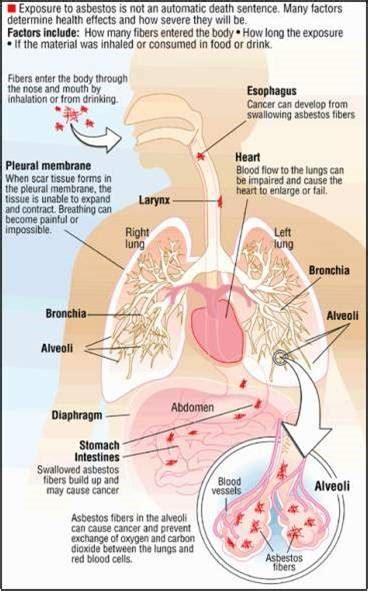 Mesothelioma paling banyak menyerang pria karena paparan asbes yang tinggi dalam pekerjaan jenis industri. ASBES