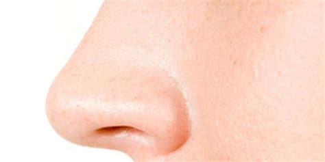 Ein nasenfurunkel kann sich aus einer entzündung eines haarbalgs am naseneingang bilden, sichtbar und fühlbar als direkt zum seiteninhalt. Nasenfurunkel