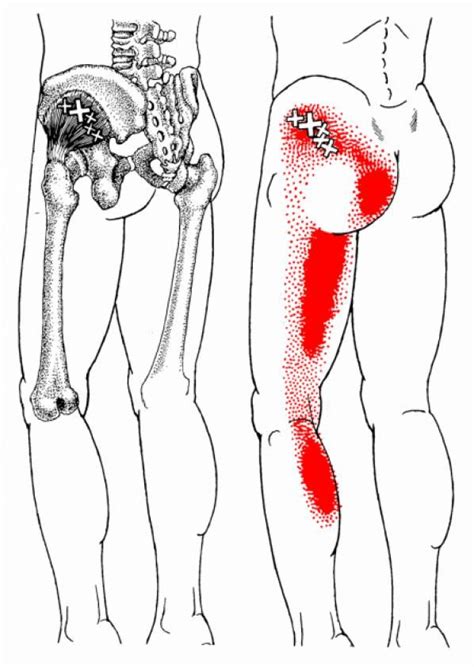 Strengthening and increasing hip flexor flexibility can also increase performance. Pin on Psoas Release