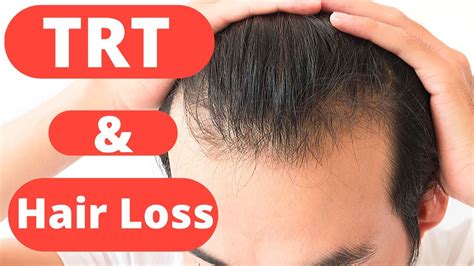 I'm 41 and have been on testosterone replacement therapy for about 4 years now. The TRUTH about TRT and Hair loss | Testosterone ...