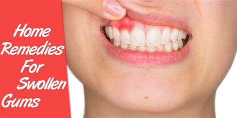 Swollen gums are usually related to a tooth infection. Home Remedies For Swollen Gums https://www ...