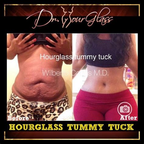 While getting comfortable after a tummy tuck and a bbl is certainly complicated, it is not impossible. Pin on tummy tuck before after