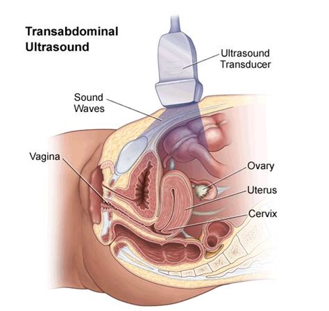 For an abdominal ultrasound test, a trained medical professional healthcare providers consider abdominal ultrasound a type of pelvic ultrasound because it evaluates your provider orders ultrasound evaluation of specific areas of your abdomen. Transabdominal Ultrasound - Female Pelvic Anatomy | Female ...