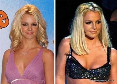 Soon after, she became the first openly transgender person to appear on a cmt show when she joined the. Celebrities Actresses before and after Breast Enlargement ...