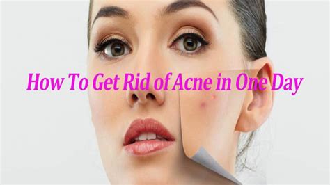 Chang, here are the ones you should look out for: How to get rid of pimple instantly - YouTube