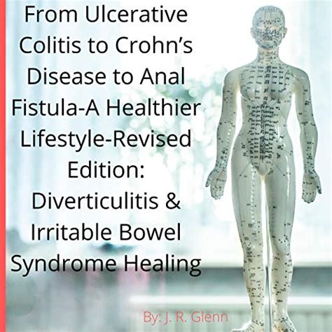 Types of fistula can be described by their location. From Ulcerative Colitis to Crohn's Disease to Anal Fistula ...