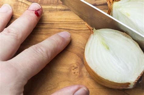 Oleh karena itu, dokter biasanya akan menyarankan pemeriksaan darah di laboratorium guna memastikan diagnosis. Gambar Tangan Berdarah Di Iris Silet