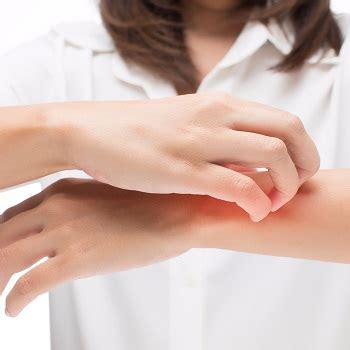 Itching in Pregnancy (Obstetric cholestasis) | Push Doctor