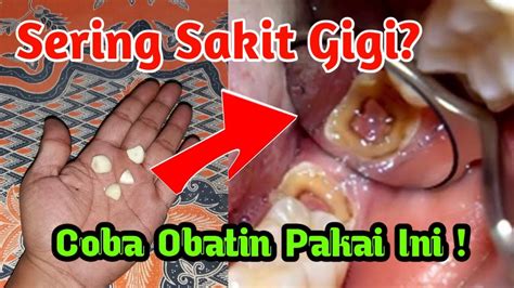 Berikut 12 cara mengobati cara mengobati sakit gigi yang ampuh dan alami pertama adalah menggunakan kompres es. Obat Sakit Gigi Paling Manjur - Macam Khasiat - YouTube