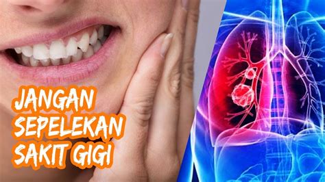 Kandungan asam mefenamat dalam ponstan membuat obat ini. JANGAN Sepelekan Sakit Gigi - YouTube