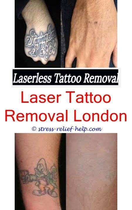 As long as the proper precautions are taken, anyone can place a brand new tattoo over a laser removed tattoo. tattoo removal london can my tattoo be completely removed ...