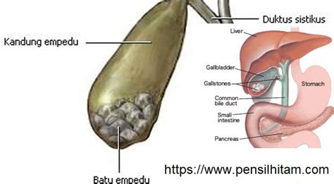 We did not find results for: Kenali Penyebab Sakit di Ulu Hati dan Cara Mengobatinya