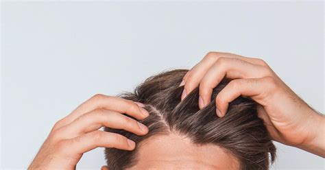 The most common cause of hair loss is a hereditary condition that happens with aging. Scabs and Sores on Scalp: Treatment, Causes, and Remedies