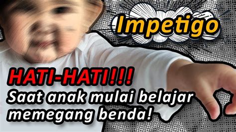 12 cara mengatasi kulit kering pada anak paling mudah di rumah. MASALAH KULIT PADA BAYI / ANAK - YouTube