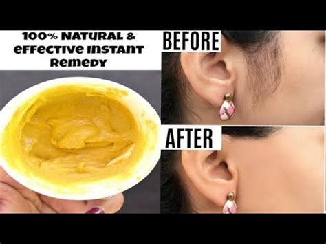 How To Remove Unwanted Hair/Best Way To Remove pubic hairs ...