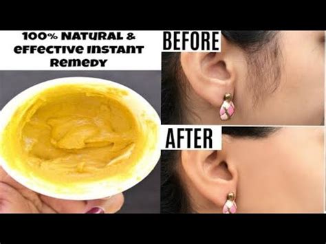 This will help to remove anything that might block your pores and lead to ingrown hairs and resulting infections. How To Remove Unwanted Hair/Best Way To Remove pubic hairs ...