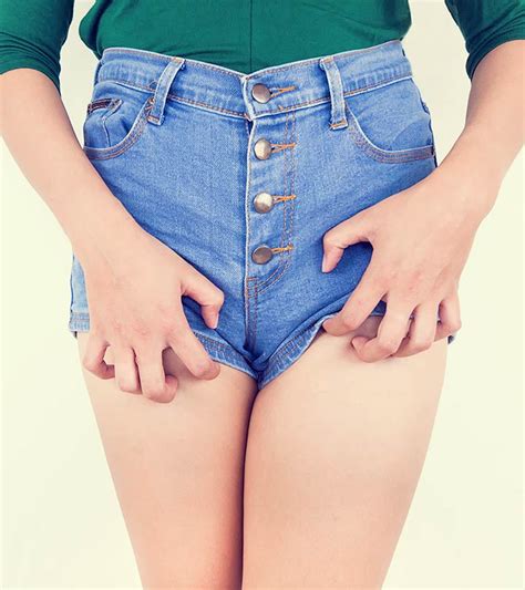 One of the most common problems faced by women and men alike is experiencing itching in the private parts at some point or the other in their. 15 Effective Home Remedies To Get Rid Of Jock Itch