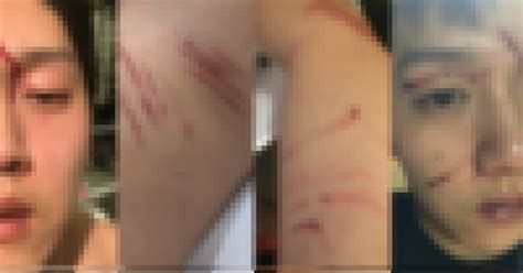 Check out some comments from the netizens regarding his wound. Goo Hara's Ex-Boyfriend Reveals Shocking Images Taken ...