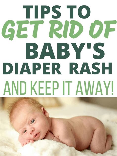 Wash your hand and take a little honey on your fingers. How to Get Rid of Baby's Diaper Rash Fast! - Oh Baby Love ...