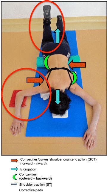 Types, diagram, related diseases and facts. 8The Schroth prone exercise with activation of the iliopsoas muscle... | Download Scientific Diagram