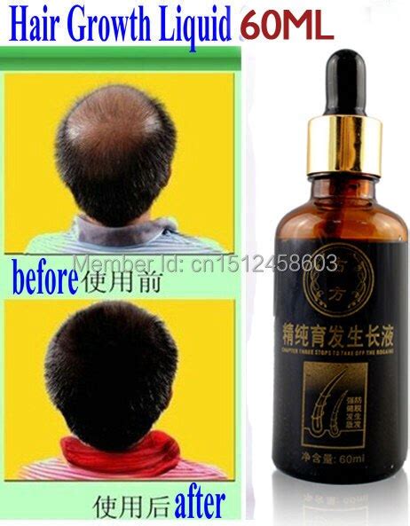 How to use chinese herbs for hair loss in menopause. Best Chinese medicine hair regrowth serum yuda pilatory ...