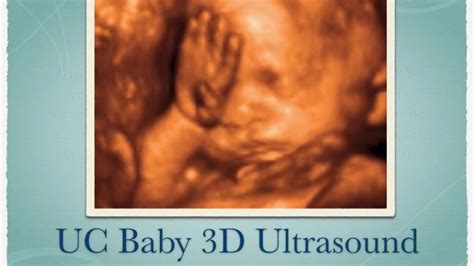 Fetal ultrasounds are tools for monitoring baby's development and tracking your pregnancy. UC Baby 3D Ultrasound Images & Client Reviews - YouTube