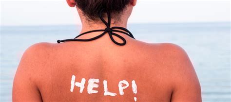 Le coup de soleil est le signe que la peau a été agressée par les rayons soleil lors d'une exposition solaire. 10 astuces pour calmer un coup de soleil - Beauté