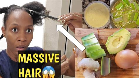 Stop hair loss and promote hair growth with this gentle and fortified combo. 3WAYS TO USE ALOE VERA FOR EXTREME HAIR GROWTH/ DEEP ...