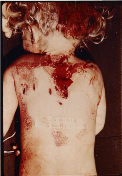 Sylvia likens crime scene photo. Jeffrey MacDonald...do you remember? GRAPHIC CRIME SCENE!