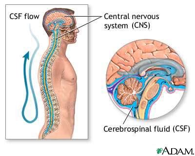 Multiple sclerosis)، ممّا يؤدي إلى فقدان تدريجي للتوازن. CSF oligoclonal banding - series: MedlinePlus Medical ...