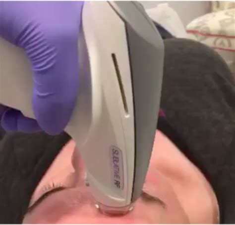 These laser hair removal machine are certified to enhance aesthetic beauty. New Randolph MA clinic advances laser hair removal and ...