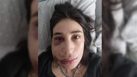 Actriz maría paz grandjean recibió fuerte impacto de balín en su rostro. Disparos al rostro: INDH se querelló contra Carabineros ...