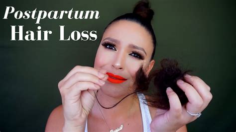 It's also believed that childbirth can be a. Postpartum Hair Loss | Why It Happens & How I Hide It ...