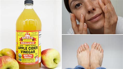 You'll just need a little soap for daily cleaning. 24 THINGS YOU CAN DO WITH APPLE CIDER VINEGAR! - My ...